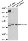 RMND5A Antibody - Western blot analysis of extracts of various cell lines, using RMND5A antibody at 1:1000 dilution. The secondary antibody used was an HRP Goat Anti-Rabbit IgG (H+L) at 1:10000 dilution. Lysates were loaded 25ug per lane and 3% nonfat dry milk in TBST was used for blocking. An ECL Kit was used for detection and the exposure time was 90s.