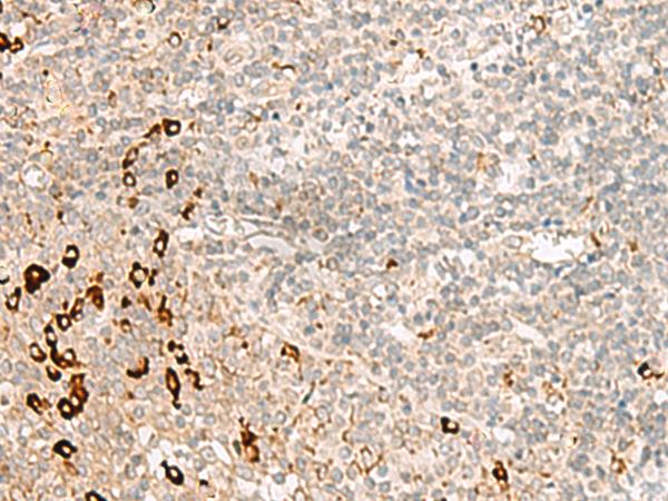 RMND5A Antibody - Immunohistochemistry of paraffin-embedded Human tonsil tissue  using RMND5A Polyclonal Antibody at dilution of 1:50(×200)