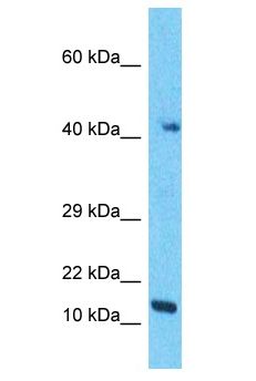 RMND5B Antibody - RMND5B antibody Western Blot of A549. Antibody dilution: 1 ug/ml.  This image was taken for the unconjugated form of this product. Other forms have not been tested.