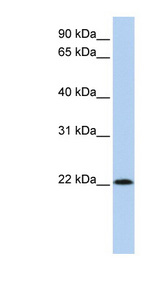 RNASE11 Antibody - RNASE11 antibody Western blot of 293T cell lysate. This image was taken for the unconjugated form of this product. Other forms have not been tested.