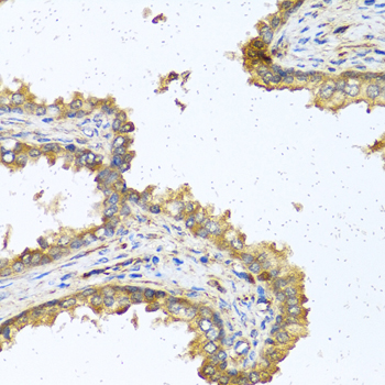 RNASE11 Antibody - Immunohistochemistry of formalin-fixed paraffin-embedded (FFPE) human prostate using RNASE11 antibody at dilution of 1:100 (40x magnification).
