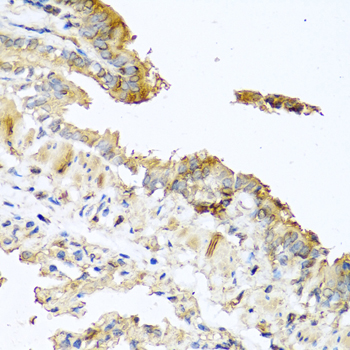 RNASE11 Antibody - Immunohistochemistry of paraffin-embedded mouse lung using RNASE11 antibodyat dilution of 1:100 (40x lens).