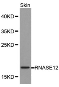 RNASE12 Antibody - Western blot analysis of skin cell lysate using RNASE12 antibody.