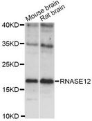 RNASE12 Antibody - Western blot analysis of extracts of various cell lines, using RNASE12 antibody at 1:1000 dilution. The secondary antibody used was an HRP Goat Anti-Rabbit IgG (H+L) at 1:10000 dilution. Lysates were loaded 25ug per lane and 3% nonfat dry milk in TBST was used for blocking. An ECL Kit was used for detection and the exposure time was 90s.