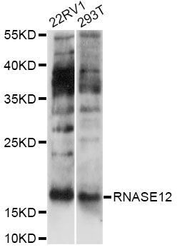 RNASE12 Antibody - Western blot analysis of extracts of various cell lines, using RNASE12 antibody at 1:1000 dilution. The secondary antibody used was an HRP Goat Anti-Rabbit IgG (H+L) at 1:10000 dilution. Lysates were loaded 25ug per lane and 3% nonfat dry milk in TBST was used for blocking. An ECL Kit was used for detection and the exposure time was 90s.