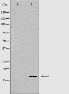 RNASE12 Antibody - Western blot analysis of skin tissue lysate using RNASE12 antibody. The lane on the left is treated with the antigen-specific peptide.