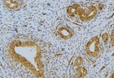 RNASE12 Antibody - 1:100 staining human uterus tissue by IHC-P. The sample was formaldehyde fixed and a heat mediated antigen retrieval step in citrate buffer was performed. The sample was then blocked and incubated with the antibody for 1.5 hours at 22°C. An HRP conjugated goat anti-rabbit antibody was used as the secondary.