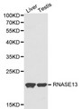RNASE13 Antibody - Western blot of RNASE13 pAb in extracts from mouse liver and testis tissues.