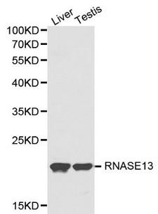 RNASE13 Antibody - Western blot of RNASE13 pAb in extracts from mouse liver and testis tissues.