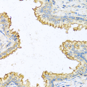 RNASE13 Antibody - Immunohistochemistry of paraffin-embedded human prostate using RNASE13 antibodyat dilution of 1:100 (40x lens).