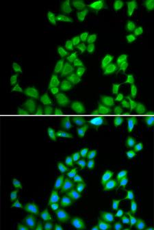 RNASE13 Antibody - Immunofluorescence analysis of MCF-7 cells using RNASE13 antibody. Blue: DAPI for nuclear staining.