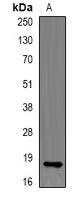 RNASE13 Antibody - Western blot analysis of RNase 13 expression in Raji (A) whole cell lysates.