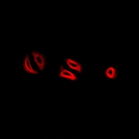RNASE13 Antibody - Immunofluorescent analysis of RNase 13 staining in MCF7 cells. Formalin-fixed cells were permeabilized with 0.1% Triton X-100 in TBS for 5-10 minutes and blocked with 3% BSA-PBS for 30 minutes at room temperature. Cells were probed with the primary antibody in 3% BSA-PBS and incubated overnight at 4 deg C in a humidified chamber. Cells were washed with PBST and incubated with a DyLight 594-conjugated secondary antibody (red) in PBS at room temperature in the dark.