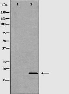 RNASE13 Antibody - Western blot analysis of liver tissue using RNASE13 antibody. The lane on the left is treated with the antigen-specific peptide.