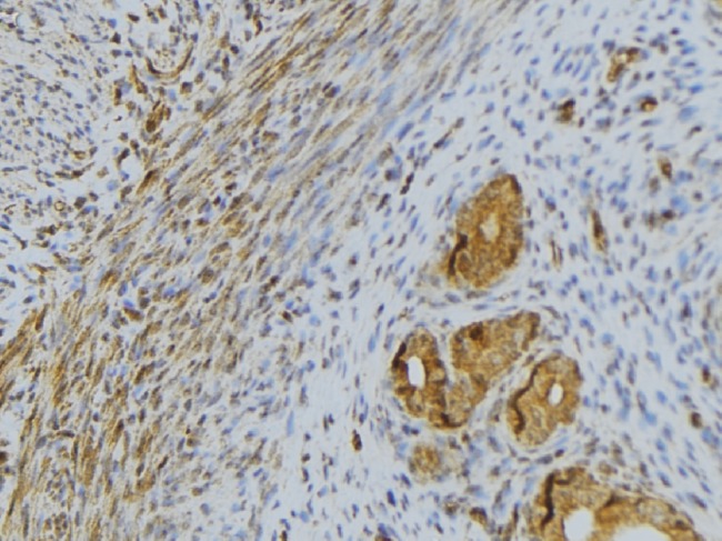 RNASE13 Antibody - 1:100 staining human uterus tissue by IHC-P. The sample was formaldehyde fixed and a heat mediated antigen retrieval step in citrate buffer was performed. The sample was then blocked and incubated with the antibody for 1.5 hours at 22°C. An HRP conjugated goat anti-rabbit antibody was used as the secondary.