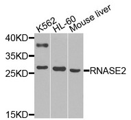 RNASE2 / EDN Antibody - Western blot analysis of extracts of various cells.