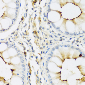 RNASE3 Antibody - Immunohistochemistry of paraffin-embedded human colon tissue.
