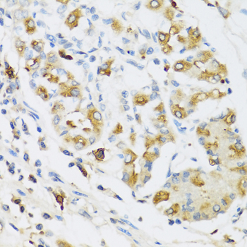 RNASE3 Antibody - Immunohistochemistry of paraffin-embedded human stomach tissue.