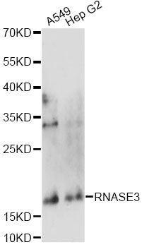 RNASE3 Antibody - Western blot analysis of extracts of various cell lines, using RNASE3 antibody at 1:1000 dilution. The secondary antibody used was an HRP Goat Anti-Rabbit IgG (H+L) at 1:10000 dilution. Lysates were loaded 25ug per lane and 3% nonfat dry milk in TBST was used for blocking. An ECL Kit was used for detection and the exposure time was 90s.