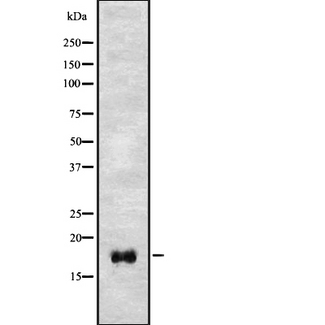 RNASE3 Antibody - Western blot analysis of ECP using COS7 whole cells lysates