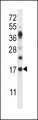 RNASE6 Antibody - RNASE6 Antibody western blot of mouse heart tissue lysates (35 ug/lane). The RNASE6 antibody detected the RNASE6 protein (arrow).