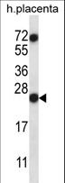 RNASE8 Antibody - RNASE8 Antibody western blot of human placenta tissue lysates (35 ug/lane). The RNASE8 antibody detected the RNASE8 protein (arrow).