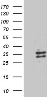 RNASE9 Antibody - HEK293T cells were transfected with the pCMV6-ENTRY control. (Left lane) or pCMV6-ENTRY RNASE9. (Right lane) cDNA for 48 hrs and lysed