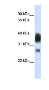 RNASEH1 Antibody - Western blot of Jurkat cell lysate using Anti-RNASEH1 Antibody.  This image was taken for the unconjugated form of this product. Other forms have not been tested.