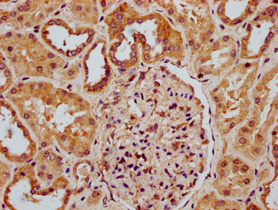 RNASEH1 Antibody - Immunohistochemistry Dilution at 1:300 and staining in paraffin-embedded human kidney tissue performed on a Leica BondTM system. After dewaxing and hydration, antigen retrieval was mediated by high pressure in a citrate buffer (pH 6.0). Section was blocked with 10% normal Goat serum 30min at RT. Then primary antibody (1% BSA) was incubated at 4°C overnight. The primary is detected by a biotinylated Secondary antibody and visualized using an HRP conjugated SP system.