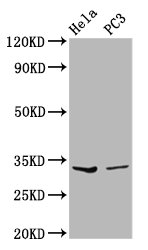 RNASEH1 Antibody - Western Blot Positive WB detected in: Hela whole cell lysate, PC3 whole cell lysate All Lanes: RNASEH1 antibody at 3.59µg/ml Secondary Goat polyclonal to rabbit IgG at 1/50000 dilution Predicted band size: 33 KDa Observed band size: 33 KDa