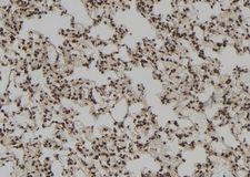 RNASEH1 Antibody - 1:100 staining rat lung tissue by IHC-P. The sample was formaldehyde fixed and a heat mediated antigen retrieval step in citrate buffer was performed. The sample was then blocked and incubated with the antibody for 1.5 hours at 22°C. An HRP conjugated goat anti-rabbit antibody was used as the secondary.