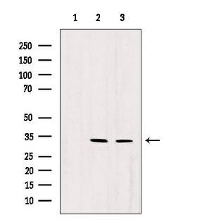 RNASEH1 Antibody - Western blot analysis of extracts of various samples using RNASEH1 antibody. Lane 1: rat brain treated with blocking peptide. Lane 2: rat brain; Lane 3: 293;