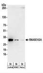 RNASEH2A Antibody - Detection of Human RNASEH2A by Western Blot. Samples: Whole cell lysate (50 ug) from Jurkat, K562, and HeLa cells. Antibodies: Affinity purified rabbit anti-RNASEH2A antibody used for WB at 0.4 ug/ml. Detection: Chemiluminescence with an exposure time of 3 minutes.