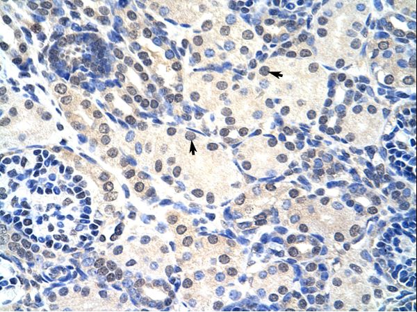 RNASEH2A Antibody - RNASEH2A antibody ARP40646_P050-NP_006388-RNASEH2A(ribonuclease H2, subunit A) Antibody was used in IHC to stain formalin-fixed, paraffin-embedded human kidney.  This image was taken for the unconjugated form of this product. Other forms have not been tested.