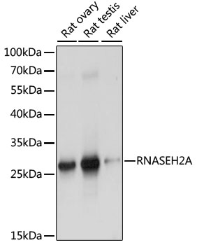 RNASEH2A Antibody - Western blot analysis of extracts of various cell lines, using RNASEH2A antibody at 1:1000 dilution. The secondary antibody used was an HRP Goat Anti-Rabbit IgG (H+L) at 1:10000 dilution. Lysates were loaded 25ug per lane and 3% nonfat dry milk in TBST was used for blocking. An ECL Kit was used for detection and the exposure time was 1s.