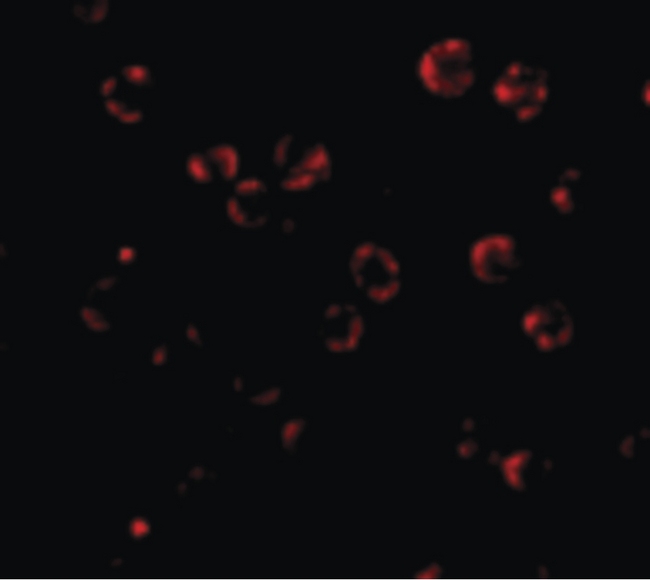 RNASEH2A Antibody - Immunofluorescence of RNAse H2A in HeLa cells with RNAse H2A antibody at 4.75 ug/ml.