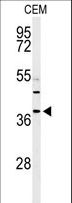 RNASEH2B Antibody - Western blot of RNASEH2B Antibody in CEM cell line lysates (35 ug/lane). RNASEH2B (arrow) was detected using the purified antibody.