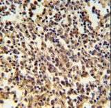 RNASEH2B Antibody - RNASEH2B Antibody IHC of formalin-fixed and paraffin-embedded human lymph tissue followed by peroxidase-conjugated secondary antibody and DAB staining.