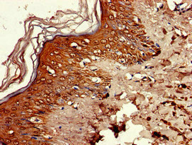 RNASEH2C / AGS3 Antibody - Immunohistochemistry image of paraffin-embedded human skin tissue at a dilution of 1:100