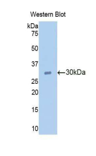 RNASEL / RNase L Antibody - Western blot of RNASEL / RNase L antibody.