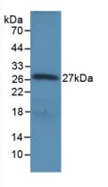 RNASEL / RNase L Antibody - Western Blot; Sample: Recombinant RNASEL, Human.