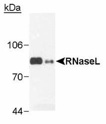 RNASEL / RNase L Antibody - RNaseL in transfected cells (0.1 ug) and Hey1B (100 ug).  This image was taken for the unconjugated form of this product. Other forms have not been tested.