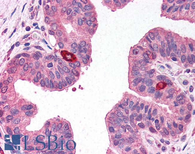 RNASEL / RNase L Antibody - Anti-RNASEL / RNase L antibody IHC of human prostate. Immunohistochemistry of formalin-fixed, paraffin-embedded tissue after heat-induced antigen retrieval. Antibody concentration 5 ug/ml.  This image was taken for the unconjugated form of this product. Other forms have not been tested.