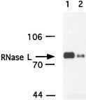 RNASEL / RNase L Antibody - RNaseL in transfected cells (0.1 ug) and Hey1B (100 ug).  This image was taken for the unconjugated form of this product. Other forms have not been tested.