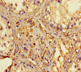 RNASEL / RNase L Antibody - Immunohistochemistry of paraffin-embedded human testis tissue using RNASEL Antibody at dilution of 1:100