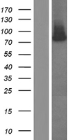 RNASEL / RNase L Protein - Western validation with an anti-DDK antibody * L: Control HEK293 lysate R: Over-expression lysate