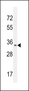 RNASET2 Antibody - RNT2 Antibody western blot of NCI-H460 cell line lysates (35 ug/lane). The RNT2 antibody detected the RNT2 protein (arrow).