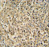 RNASET2 Antibody - RNT2 antibody immunohistochemistry of formalin-fixed and paraffin-embedded human spleen carcinoma followed by peroxidase-conjugated secondary antibody and DAB staining.