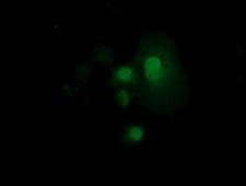 RND1 Antibody - Anti-RND1 mouse monoclonal antibody  immunofluorescent staining of COS7 cells transiently transfected by pCMV6-ENTRY RND1.