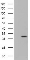 RND1 Antibody - HEK293T cells were transfected with the pCMV6-ENTRY control (Left lane) or pCMV6-ENTRY RND1 (Right lane) cDNA for 48 hrs and lysed. Equivalent amounts of cell lysates (5 ug per lane) were separated by SDS-PAGE and immunoblotted with anti-RND1.